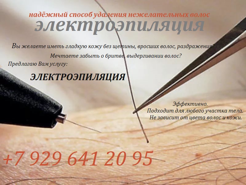 Электроэпиляция