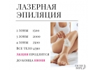 Лазерная эпиляция недорого